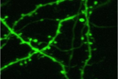 Misurato il cloro in un cervello vivo