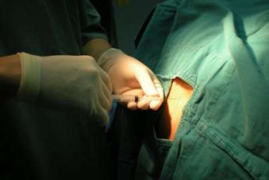  Cellule staminali, anche al Fazzi trapianti da donatori non consanguinei