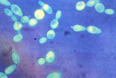 Il lievito di birra e le disfunzioni neurodegenerative