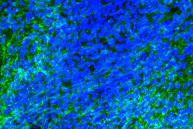 Sclerosi multipla: il ruolo della microglia nella riparazione della mielina