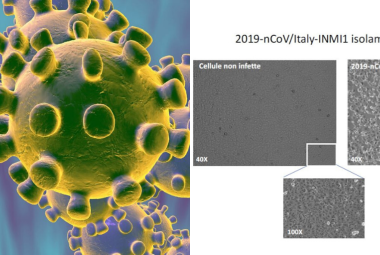 Coronavirus, 19 pazienti sotto osservazione allo Spallanzani