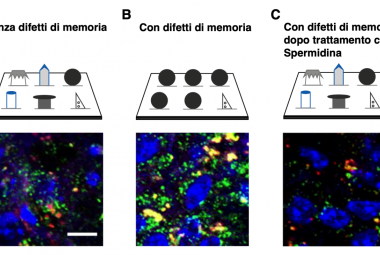Gli effetti della Spermidina nelle malattie neurodegenerative