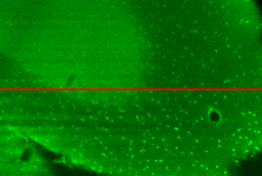 Lenti 'intelligenti' per studiare il cervello al microscopio