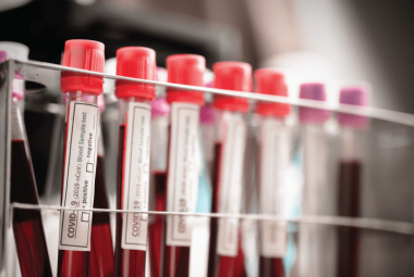 Covid-19. Da una ricerca italiana nuove prospettive per combatterlo