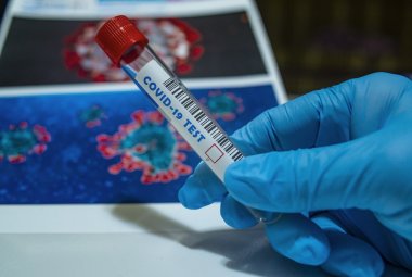 Tamponi molecolari. Negli hub di Lecce e Taurisano si va solo se convocati