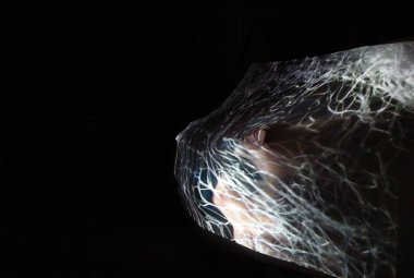 'Luce' a Palazzo Mongiò dell'elefante