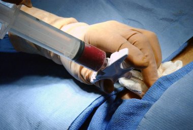 “Ehi tu! Hai midollo?” Giornata della donazione