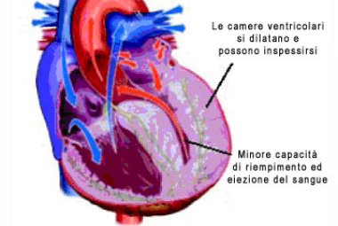 Il Sole 24 ore: "Nella Asl di Lecce curano bene lo scompenso cardiaco e fanno risparmiare"