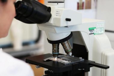 Microscopio e laser per la prevenzione del tumore alla cervice