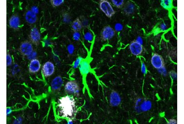 Immagine della corteccia somatosensoriale del modello murino, ottenuta al microscopio. Sono visibili gli astrociti (in verde), gli accumuli di beta-amiloide (in bianco) e i nuclei cellulari (in blu) 